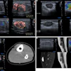 Medical ultrasound and CT scan imaging panels showing diagnostic vascular and abdominal studies with Doppler flow analysis
