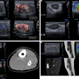 Medical ultrasound and CT scan imaging panels showing diagnostic vascular and abdominal studies with Doppler flow analysis