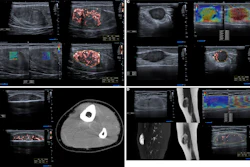 Medical ultrasound and CT scan imaging panels showing diagnostic vascular and abdominal studies with Doppler flow analysis