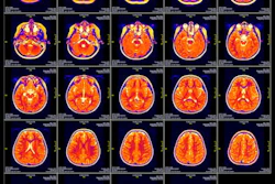 Mri Slide 400