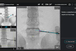 Image Vuze Spinal Surgery Guidance Software