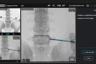 Image Vuze Spinal Surgery Guidance Software