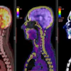 Brain PET/CT imaging is one of the diagnostic applications of nuclear medicine.