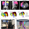 Medical CT scan visualization showing coronal, sagittal, and axial views with 3D organ segmentation including kidney, liver, aorta, and tumor models.