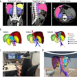 Medical CT scan visualization showing coronal, sagittal, and axial views with 3D organ segmentation including kidney, liver, aorta, and tumor models.