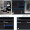 Radiologist comparing chest X-ray analysis with and without AI assistance using medical imaging software