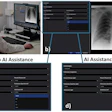Radiologist comparing chest X-ray analysis with and without AI assistance using medical imaging software