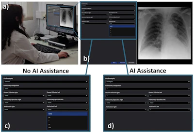 Radiologist comparing chest X-ray analysis with and without AI assistance using medical imaging software