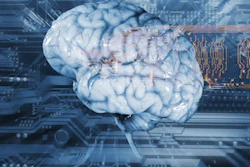 Digital brain overlaid on circuit board representing artificial intelligence and neural networks technology