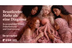Five diverse women in pink textured clothing with text about breast cancer awareness and ESR organization logo