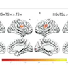Brain fMRI activation maps showing statistical comparisons of temporal-spatial processing regions with color-coded intensity scales