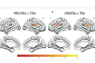 Brain fMRI activation maps showing statistical comparisons of temporal-spatial processing regions with color-coded intensity scales