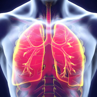 Anatomical illustration of human lungs with bronchial branches and pulmonary blood vessels highlighted in pink and yellow