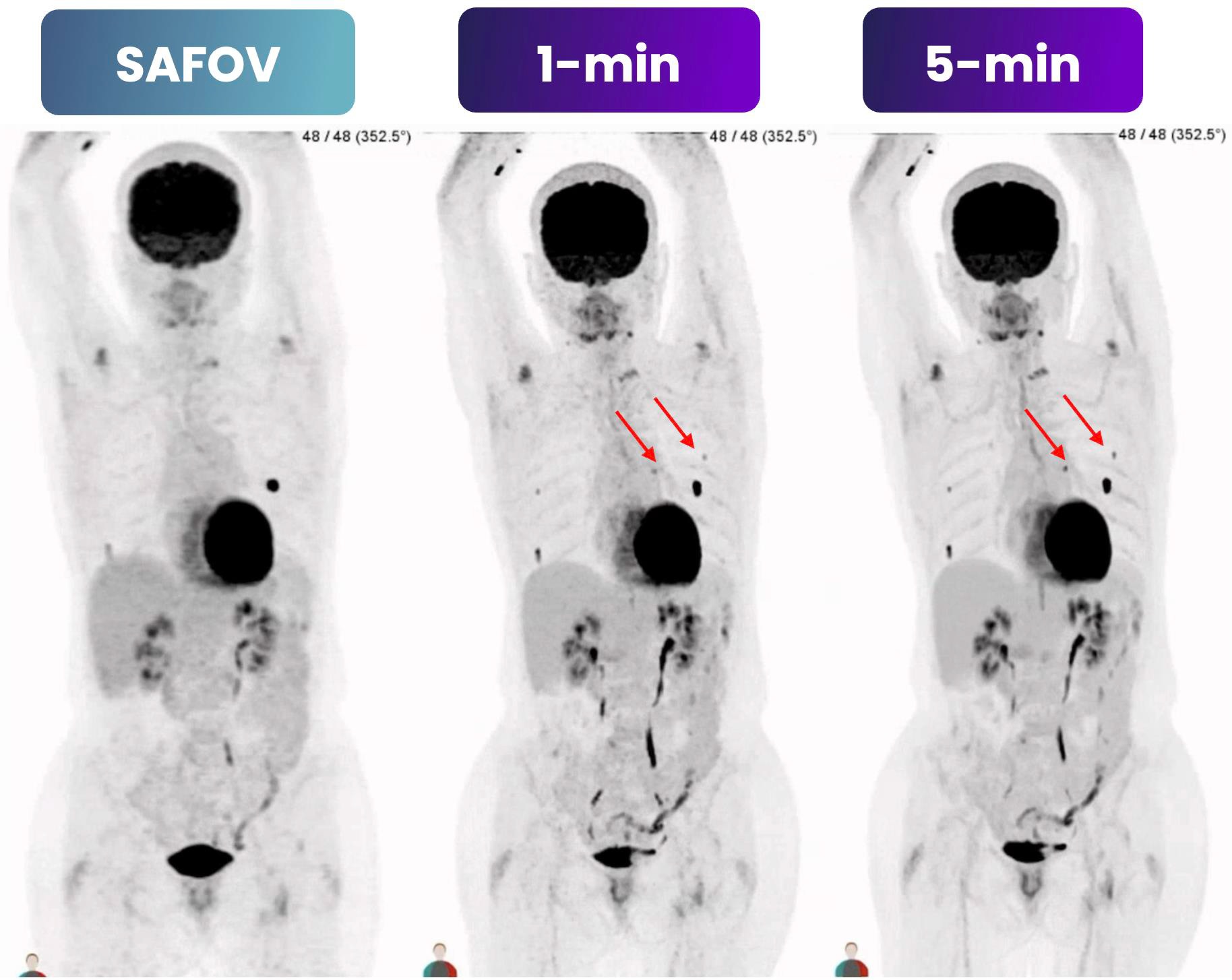 PET scan comparison showing SAFOV baseline and 1-minute and 5-minute time-point imaging with tracer uptake patterns