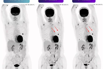 PET scan comparison showing SAFOV baseline and 1-minute and 5-minute time-point imaging with tracer uptake patterns