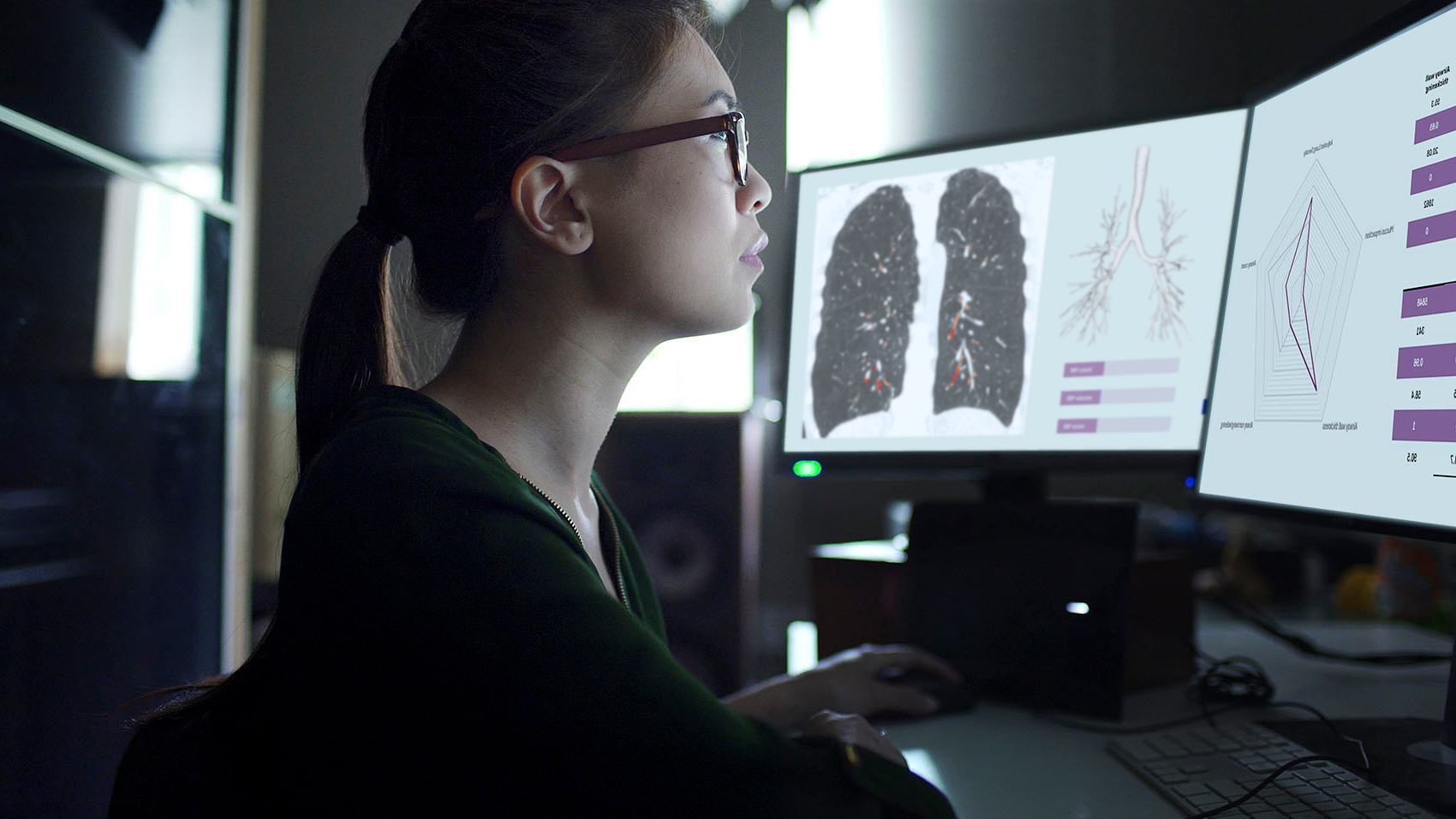 Medical professional reviewing lung CT scan images on multiple monitors in diagnostic workstation