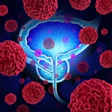 Medical illustration of prostate gland surrounded by red cancer cells on blue background