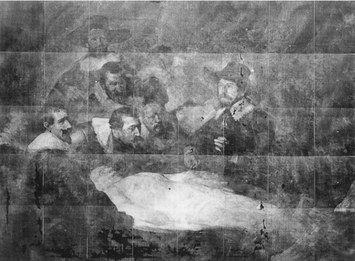 Historical black and white photograph showing men gathered around a table examining a deceased person during what appears to be a medical or forensic procedure.